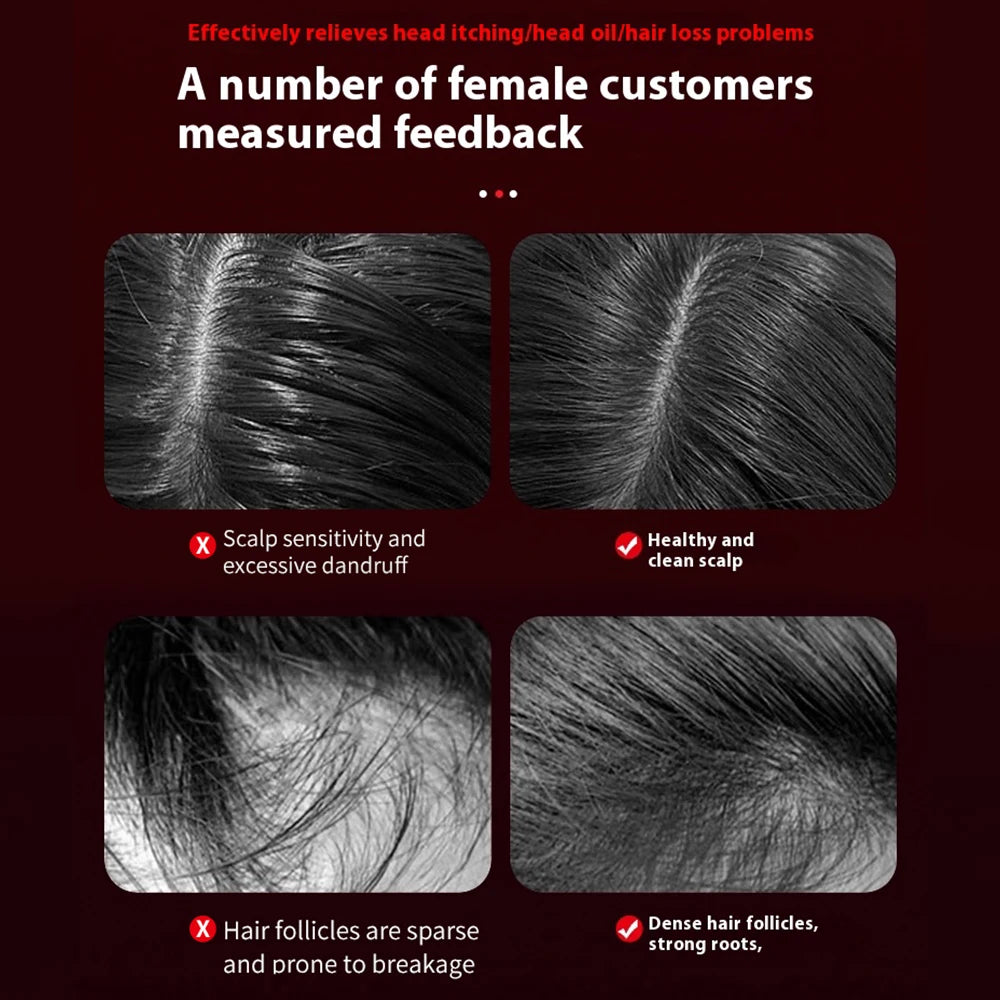 Revitalique™ Red Light Scalp Comb
